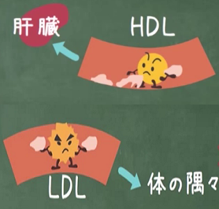 HDL　LDL　図解